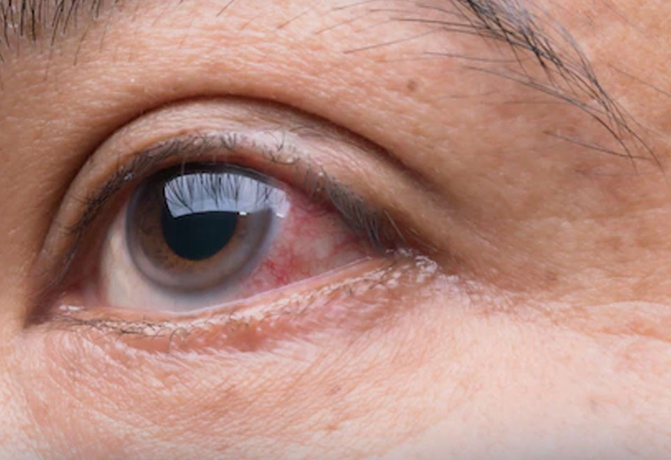 Diagnóstico e acompanhamento de glaucoma, Dra. Giovanna Piccinini
